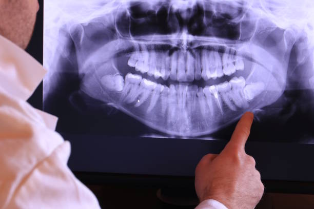 Best 24-Hour Emergency Dentist in Mansfield Center, CT